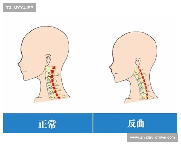 有效预防颈椎疾病的日常习惯与生活方式调整建议 有效预防颈椎疾病的日常习惯与生活方式调整建议